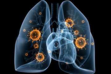 Viêm phổi mắc ngoài cộng đồng nguy hiểm như thế nào?